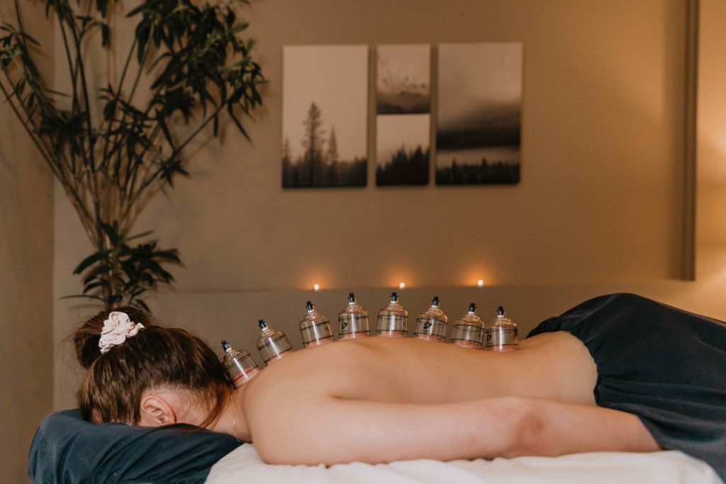 A woman laying on a treatment receiving a myofascial cupping treatment with cups down her back to promote relaxation and healing